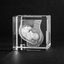 3D Glas Modell Schwangerschaft: Unterleib mit Baby