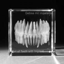 3D Modell vom menschlichen Gebiss mit Implantaten, Zähne in Glas