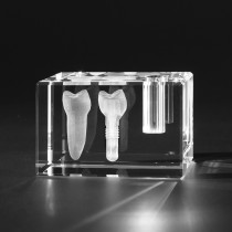 3D Zahnmodell Backenzahn und Zahnimplantat. Dentalmotive in Glas
