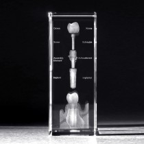 3D Zahnimplantat Aufbau, Zahnmodell für Zahnärzte, Dentalmotive in Kristallglas gelasert