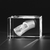 3D Modell einer verkalkten Arterie in Kristall Glas